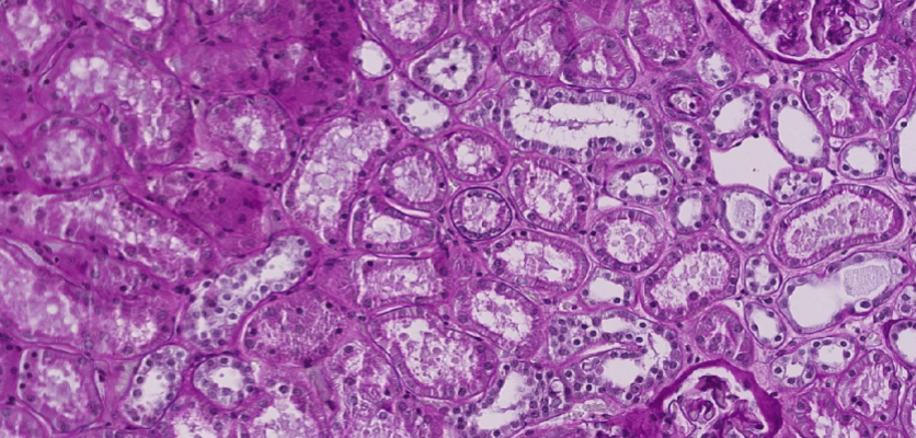 An example of a microscope slide from the kidneys