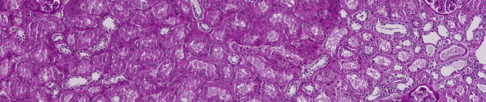 Image from PAS stained slide of the kidneys