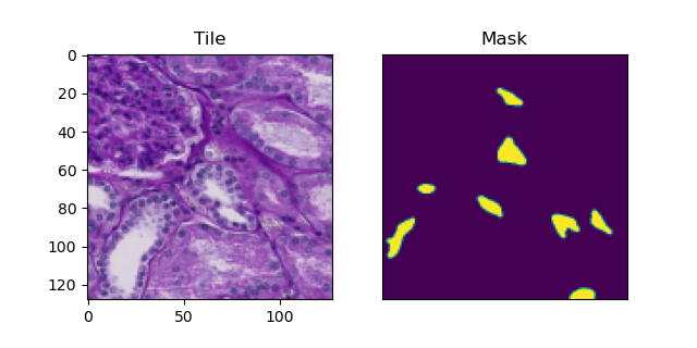 Fig 1. Mask generated for a training example.