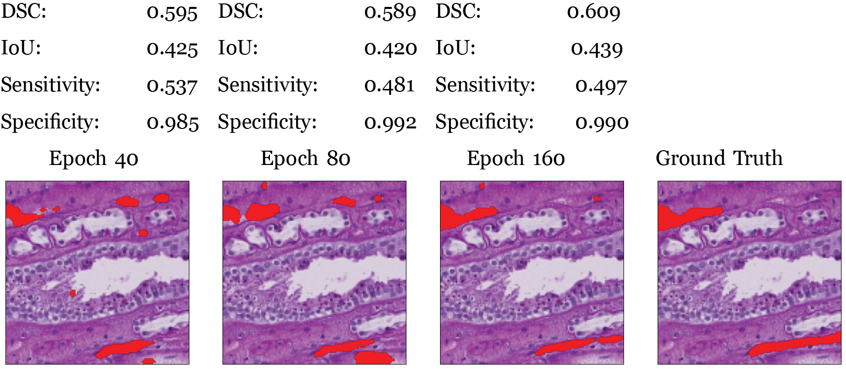 Table 3. Metrics over validation set from the models at 40th, 80th and 160th epoch with an example. Refer to table 1 for examples of these metrics on simpler segmentations.