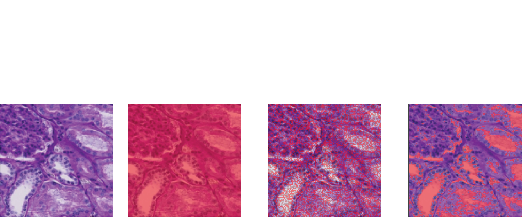 Table 1. Comparison of different algorithms. The metrics are calculated by averaging across the entire training set. The full and no segmentation scores demonstrate the class proportions.